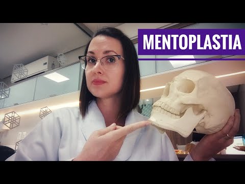 Vídeo: O Que é Mentoplastia?