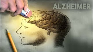 Alzheimer: Entendendo mais sobre essa doença