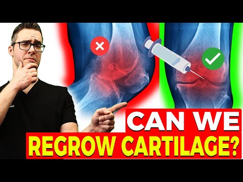 Can We Reverse Arthritis & Regrow Cartilage? [New Studies]