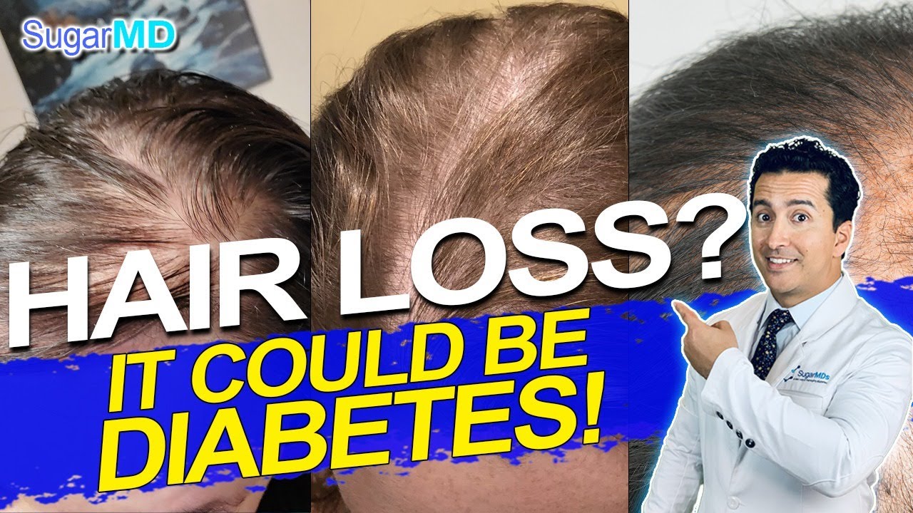 How To Treat Hair Loss From Diabetes With Ayurveda – Vedix