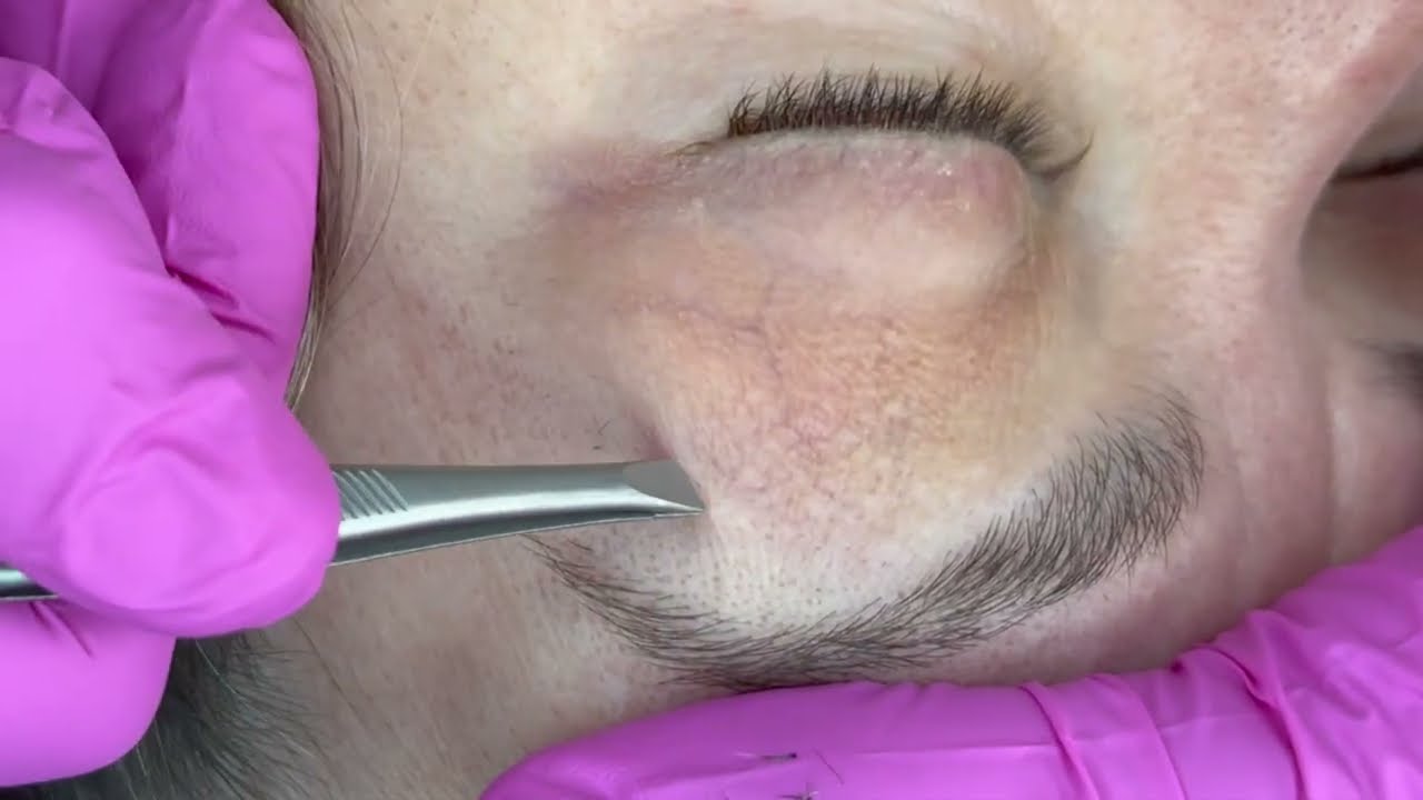 🌙Brow Tweezing For Deep Sleep😴💆‍♀️