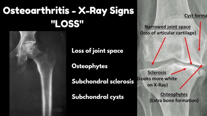 Seksual onalar bilan porno tomosha qiling