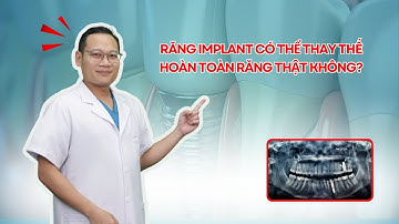 Răng implant có thể thay thế hoàn toàn răng thật không? | Nha khoa MARINA