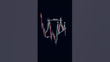Head and Shoulders Pattern Trading | Smart Trend Continuation Setup