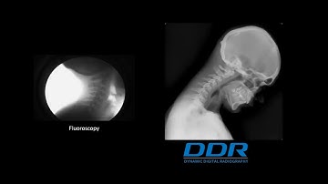 X Ray That Moves! DDR( Digital Dynamic Radiograhpy) by Konica Minolta