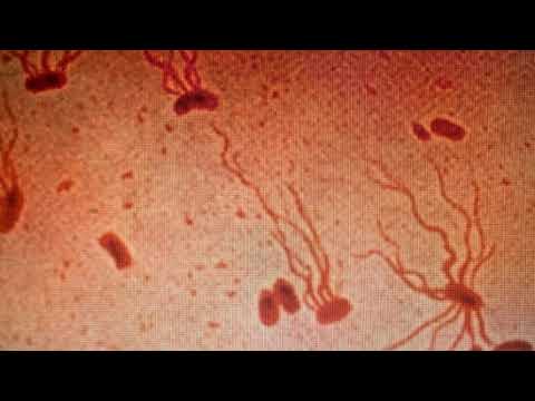 Стародавні бактерії черевного тифу блискавично розвивають стійкість до антибіотиків