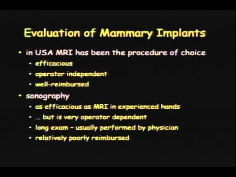 IBU Ultrasound of Breast Implants StavrosTRIMMED