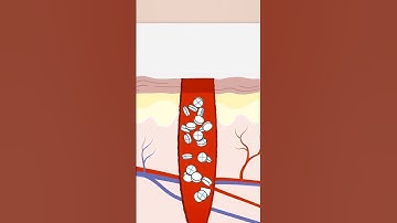 This Tool Can Stop Bullet Wounds in Just 20 Seconds!