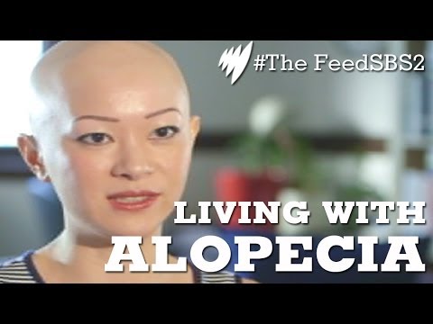 Living With Alopecia