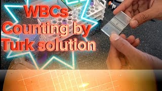 WBCs Counting test by Turk solution فحص عد خلايا الدم البيضاء بطريقه @SamyKhwiter #سامى_حسن_خويطر