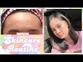 how to get rid of tiny bumps on forehead! my skincare routine ❀ | Philippines
