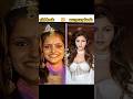 TV serial actress ki old 🆚 surgery look/#trending#viral#