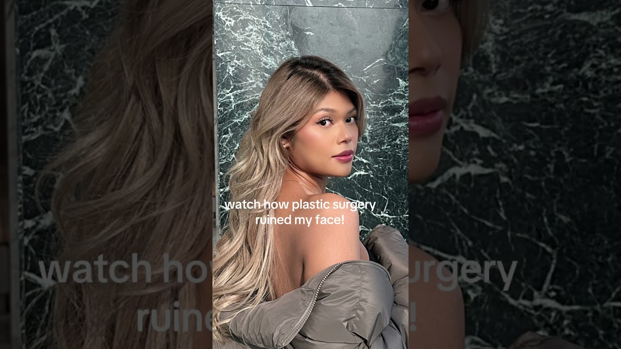 PLASTIC SURGERY RUINED MY FACE 😰 