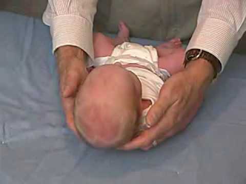 neurology exam: newborn-abnormal: Head Shape and Sutures