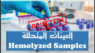 كيف تمنع رفض - العينات المسحوبة - العينات المتحللة - Hemolyzed Samples