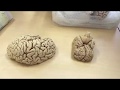 Анатомия. Ствол Головного Мозга