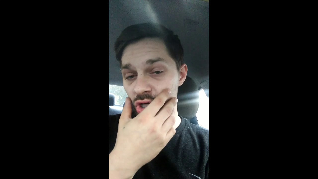 Dillon's Denture Adventure! E3 toothless in public! YouTube