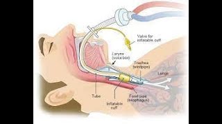 Principles of Airway Management and Ventilation