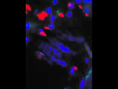 ﺧﺮﺍﺏ ﺧﺮﺑﻨﺎ ﺣﺸﻴﺶ ﻓﺮﻃﻨﺎ ﻭﺧﺮﺑﻮﻟﻴﻲ