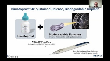 Glaucoma: Sustained-Release Drug Delivery System, Topical Agents, and Emerging 3D Visualization