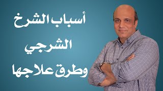 أسباب الشرخ الشرجي وطرق علاجها