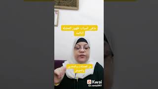 ماهى اسباب ظهور العضله النائمه