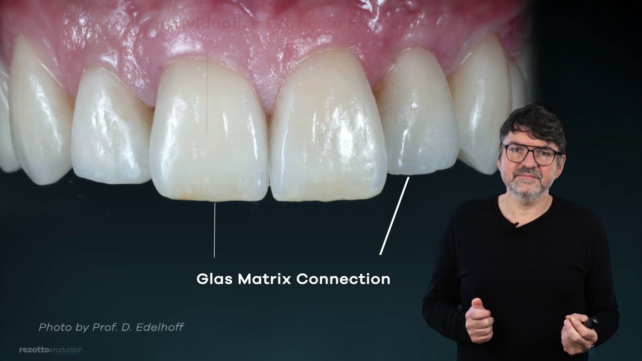 DCM Hotbond - A glass matrix solution for dental bonding (Tutorial)