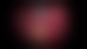 Hystrectomy   3 minutes edition 1