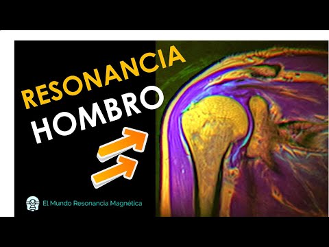 resonancia magnetica