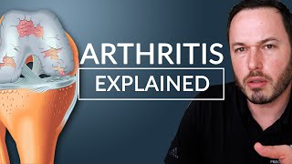 What is ARTHRITIS / OSTEOARTHRITIS?