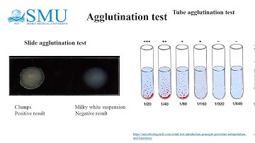 №2 Serological tests
