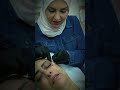 اكتشفي سر الشباب الدائم مع Endolift