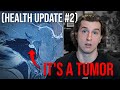 It&#39;s a tumor! (Health Update #2)