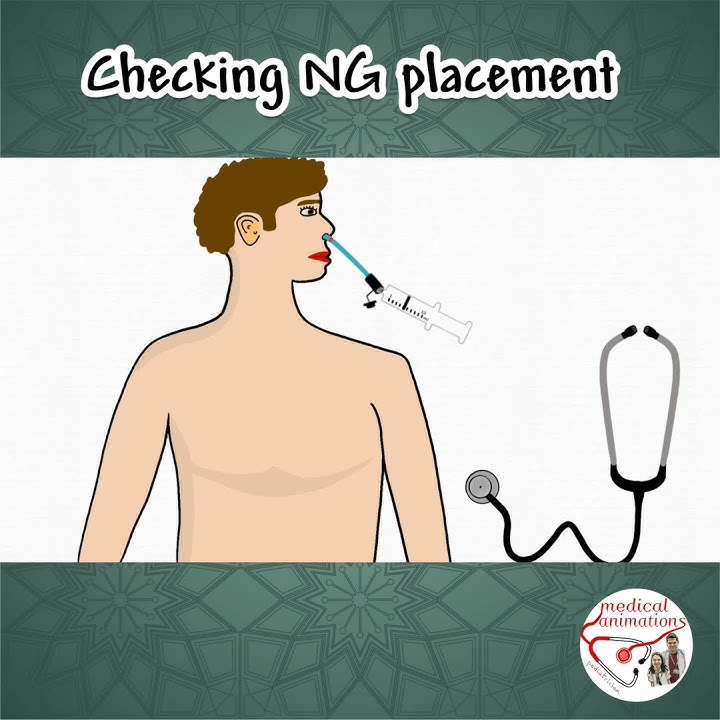 HOW TO CHECK NG TUBE ?
