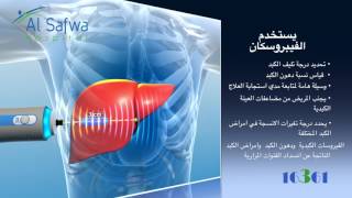 الفيبروسكان  الجهاز الاحدث عالميا حصريا بمستشفي الصفوة