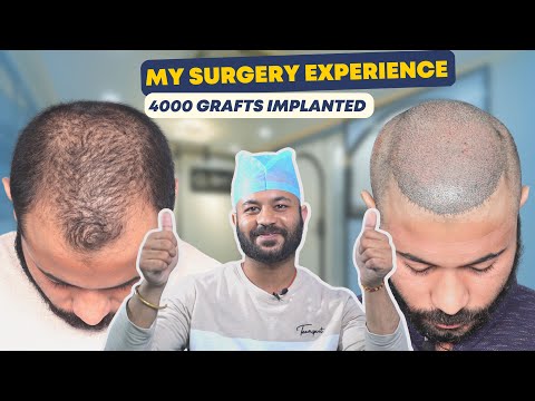 Best Hair Transplant Clinic in India  Hair Transplant Best Results