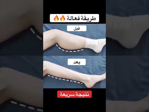 تنحيف الأرجل