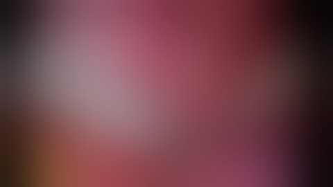 Left Thoracoscopic Approach for Convergent AF Ablation: How to do Everything From the Same Side