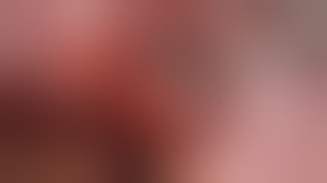 Hilum First-Fissure Last Biportal VATS Right Lower Lobectomy for Lung Cancer