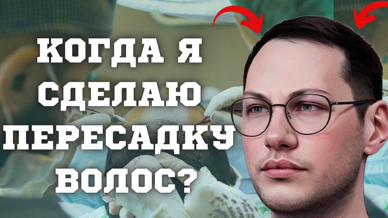 ПЕРЕСАДКА ВОЛОС ЦЕНА ОШИБКИ | СТОИТ ПЕРЕСАДКА ВОЛОС СВОИХ ДЕНЕГ и УСИЛИЙ | ПЕРЕСАДКА ВОЛОС У МУЖЧИН