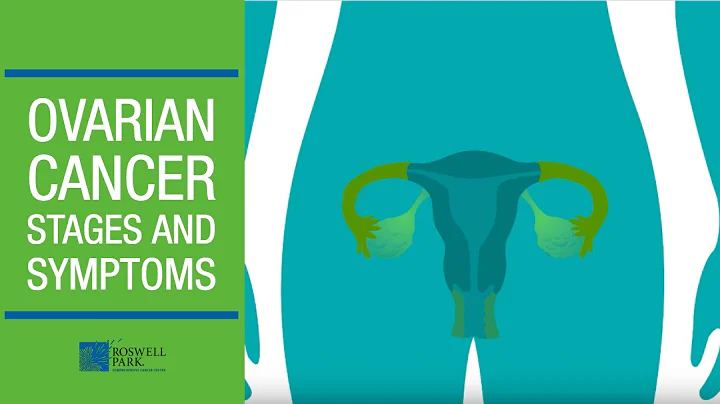 Understanding Ovarian Cancer Stages and Symptoms - DayDayNews