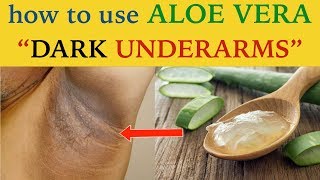 Republik Angreb metallisk 3 ways to use aloe vera to get rid of dark underarms | home remedies by  simplistic Tuber - YouTube