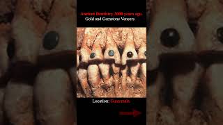 Gold and gemstone veneers, 3000+ years ago.