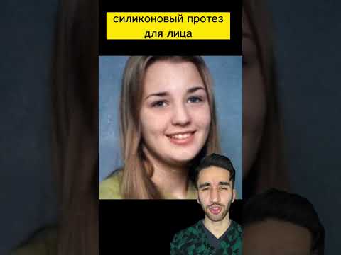 силиконовый протез лица