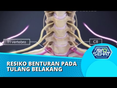 Video: Adakah vertebra yang hancur sembuh?