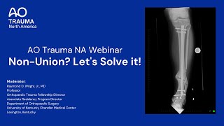 AO Trauma NA Webinar:  Non-Union? Let's Solve It! screenshot 4