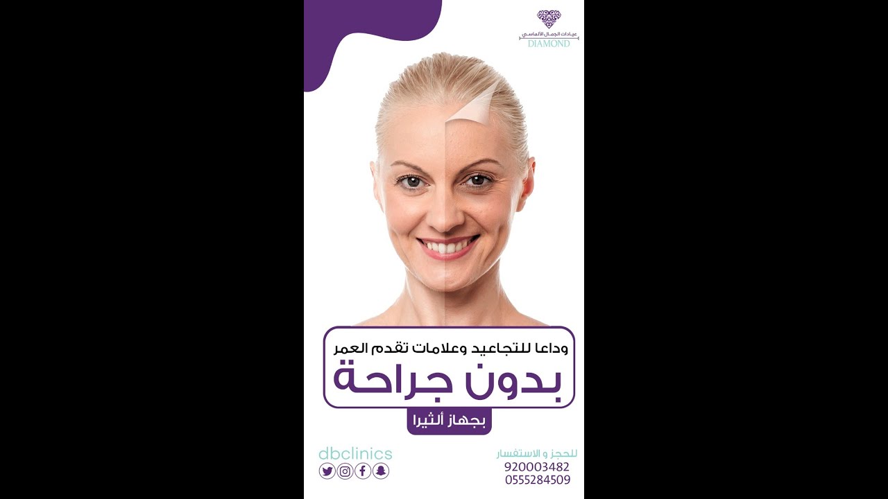 جهاز الالثيرا لشد البشرة و الجلد ولشد الوجه - الرقبة - الجفون - الحواجب بدون جراحة بديل جهاز الهايفو