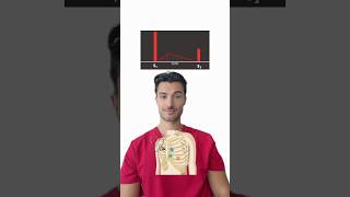 Heart Murmur Challenge 🩺🫀 #medstudent #medschool #usmle #usmlestep1 #umslestep2 #cardiology