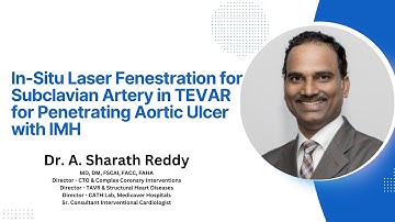 In-Situ Laser Fenestration for Subclavian Artery in TEVAR for Penetrating Aortic Ulcer with IMH