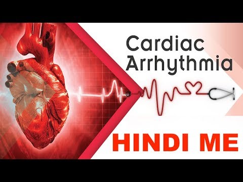 What is Arrhythmias? || Tachycardia VS Bradycardia in Hindi || Medical Guruji